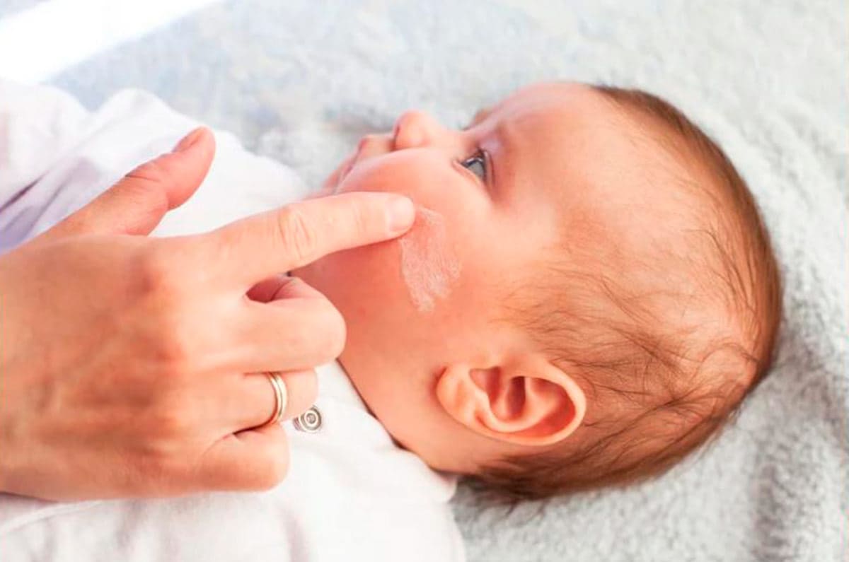 Um bebê deitado enquanto medica examina a pele do rosto
